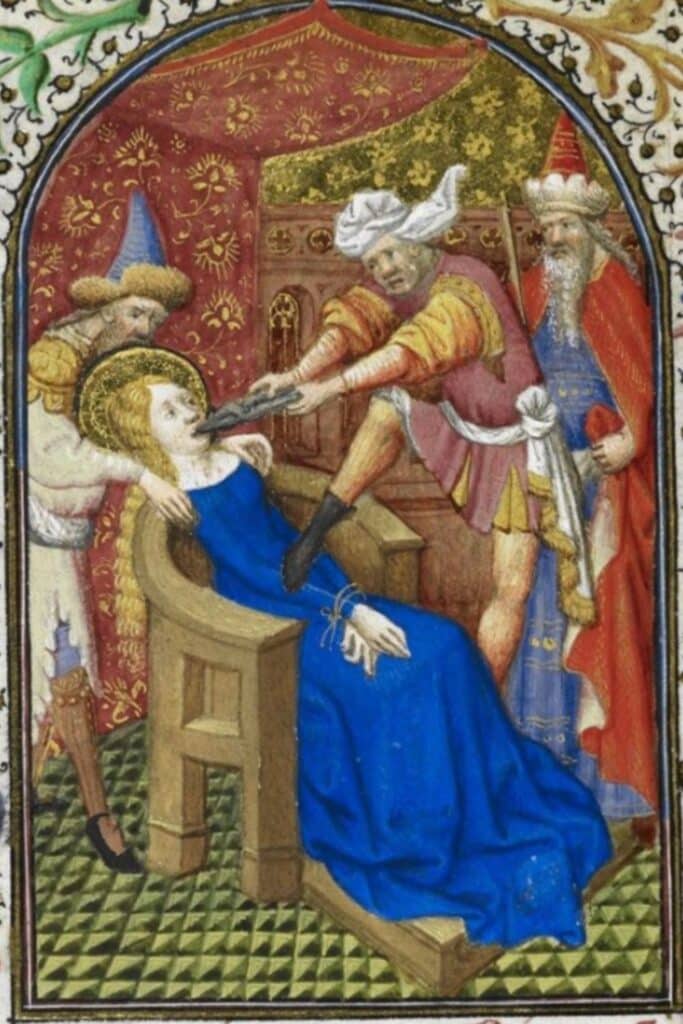 Illuminated medieval manuscript showing a woman being restrained while a man uses tongs to extract her tooth, illustrating the brutal and painful nature of dentistry in the Middle Ages.